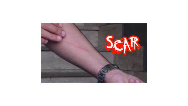 Scar by Dan Alex